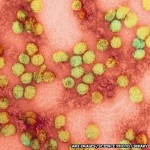 Yellow Fever Virus